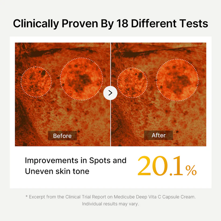 Final 3 Hours: 70%OFF🔥Mix & Match Boba Cream Set | Tiktok Viral Capsule Creams for Uneven Skin Tone, Glow Hydration, Korean Skincare, K-beauty